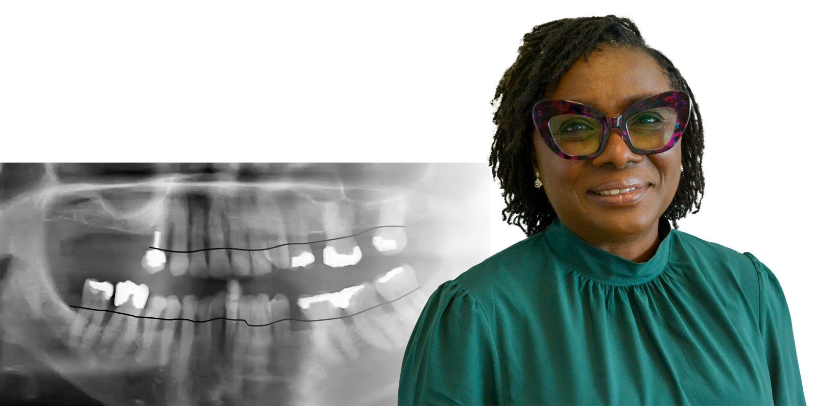 Dr Adejumoke Adeyemi - Ikigai webinar