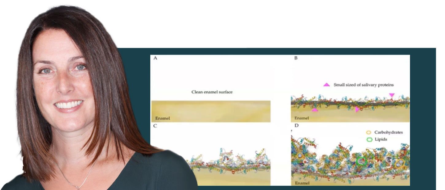 Is fluoride the only option?