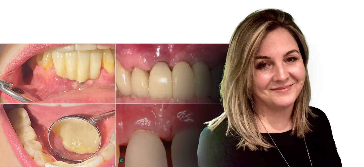 Kathryn Mayo - Essentials of implant assessment