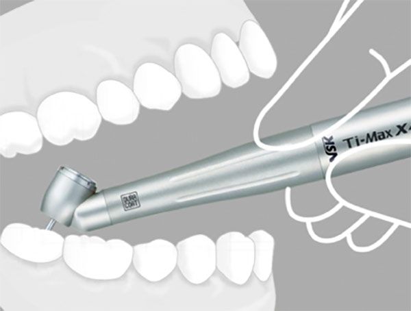 Ti-max turbine handpiece